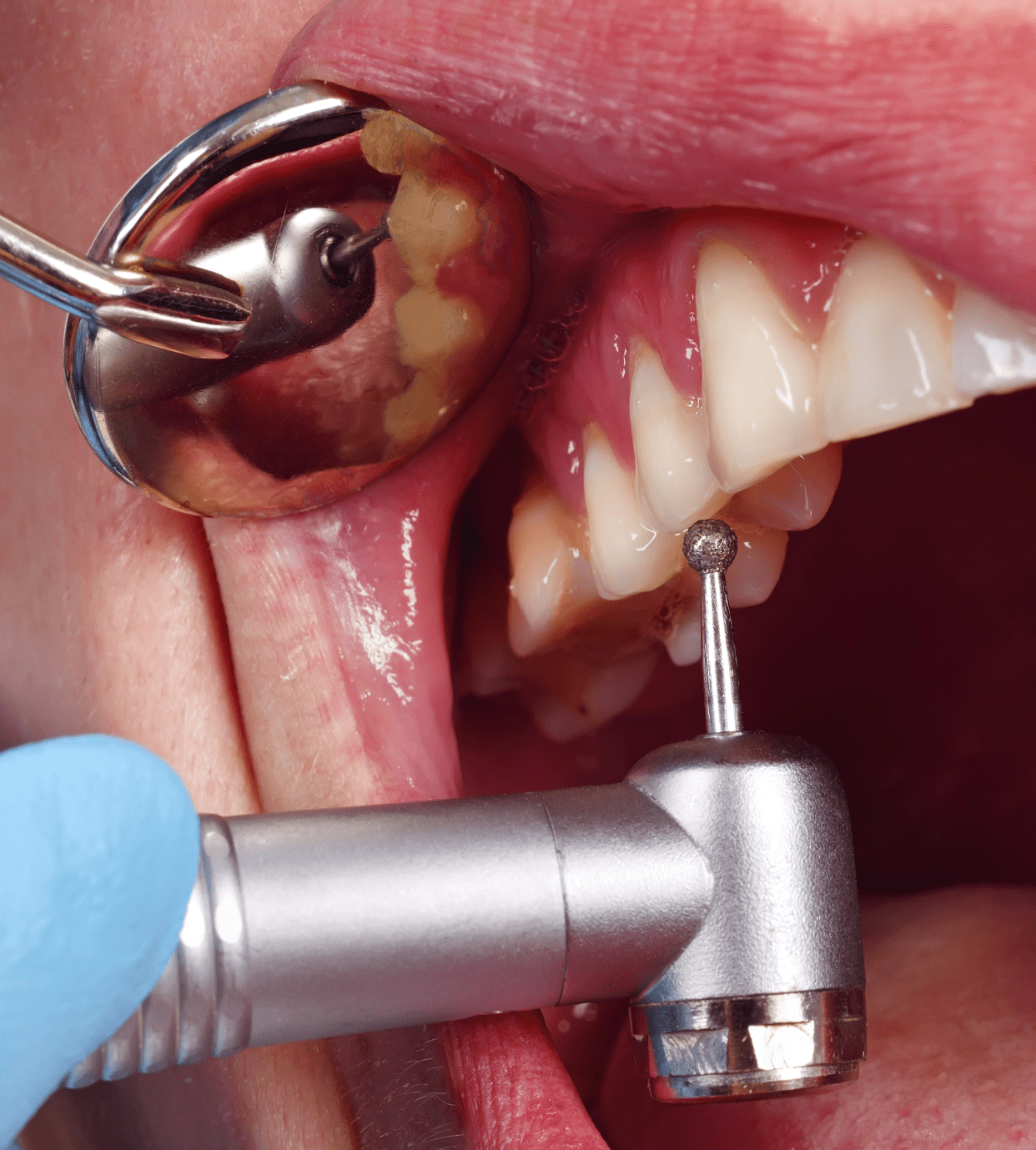 clinica-dental-condesa-en-morelia-michoacan.jpg